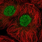 Immunofluorescent staining of human cell line A-431 shows localization to nucleoplasm.