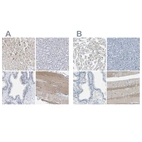 Immunohistochemical staining of human heart muscle, liver, prostate and skeletal muscle using Anti-XIRP1 antibody HPA016750 (A) shows similar protein distribution across tissues to independent antibody HPA018458 (B).