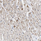 Immunohistochemical staining of human heart muscle shows moderate positivity in intercalated discs.