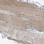 Immunohistochemical staining of human skeletal muscle shows moderate cytoplasmic positivity in myocytes.
