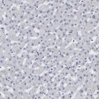 Immunohistochemical staining of human liver shows no positivity in hepatocytes as expected.