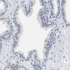 Immunohistochemical staining of human prostate shows no positivity in glandular cells as expected.