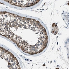 Anti-ACP1 Antibody