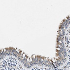 Anti-ZDHHC13 Antibody