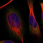Immunofluorescent staining of human cell line U-251 MG shows localization to cytosol.