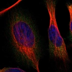 Immunofluorescent staining of human cell line U-251 MG shows localization to cytosol.