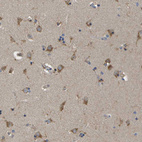 Anti-ZDHHC17 Antibody