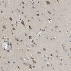 Immunohistochemical staining of human cerebral cortex shows moderate cytoplasmic and membranous positivity in neurons.