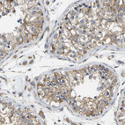 Immunohistochemical staining of human testis shows moderate membranous and cytoplasmic positivity in cells in seminiferous ducts.