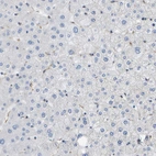 Immunohistochemical staining of human liver shows no positivity in hepatocytes as expected.