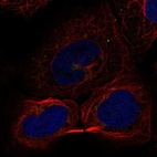 Immunofluorescent staining of human cell line U-2 OS shows localization to the Golgi apparatus & vesicles.
