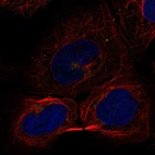 Immunofluorescent staining of human cell line U-2 OS shows localization to the Golgi apparatus & vesicles.