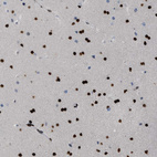 Anti-ZBTB20 Antibody