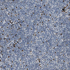 Immunohistochemical staining of human tonsil shows strong nuclear positivity in non-germinal center cells.