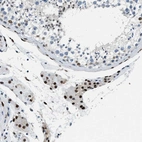 Immunohistochemical staining of human testis shows strong nuclear positivity in Leydig cells.