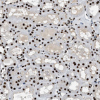 Immunohistochemical staining of human kidney shows strong nuclear positivity in cells in tubules.