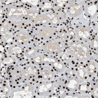 Anti-ZBTB20 Antibody