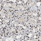 Immunohistochemical staining of human kidney shows strong nuclear positivity in cells in tubules.