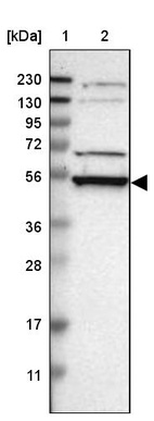 Lane 1: Marker [kDa] 230, 130, 95, 72, 56, 36, 28, 17, 11_br/_Lane 2: Human cell line RT-4