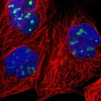 Immunofluorescent staining of human cell line A-431 shows localization to nucleoli.