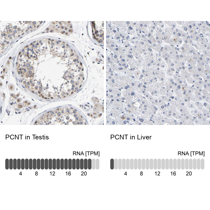 Anti-PCNT Antibody