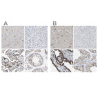 Immunohistochemical staining of human cerebral cortex, liver, placenta and testis using Anti-PCNT antibody HPA016820 (A) shows similar protein distribution across tissues to independent antibody HPA019887 (B).
