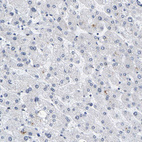 Immunohistochemical staining of human liver shows no positivity in hepatocytes as expected.