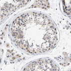 Immunohistochemical staining of human testis shows moderate cytoplasmic positivity in cells in seminiferous ducts.