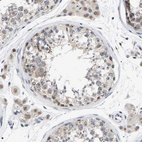 Immunohistochemical staining of human testis shows moderate cytoplasmic positivity in cells in seminiferous ducts.