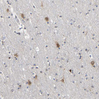 Immunohistochemical staining of human cerebral cortex shows strong cytoplasmic positivity in neurons.