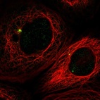 Immunofluorescent staining of human cell line A-431 shows localization to centrosome.