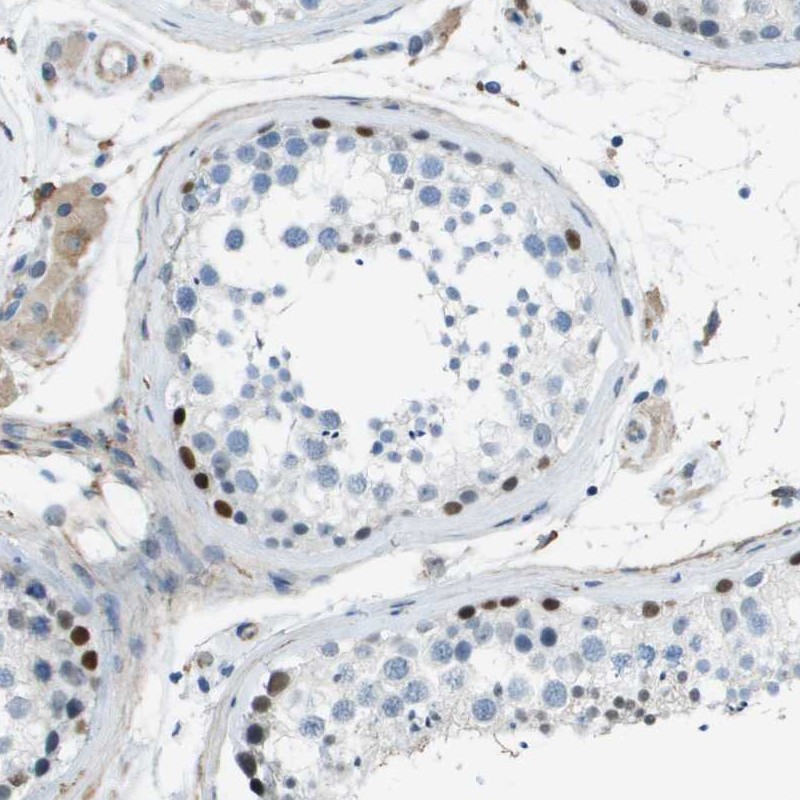 Anti-ZBTB43 Antibody