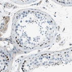 Anti-ZBTB43 Antibody