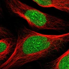 Immunofluorescent staining of human cell line U-2 OS shows localization to nucleus & nucleoli.