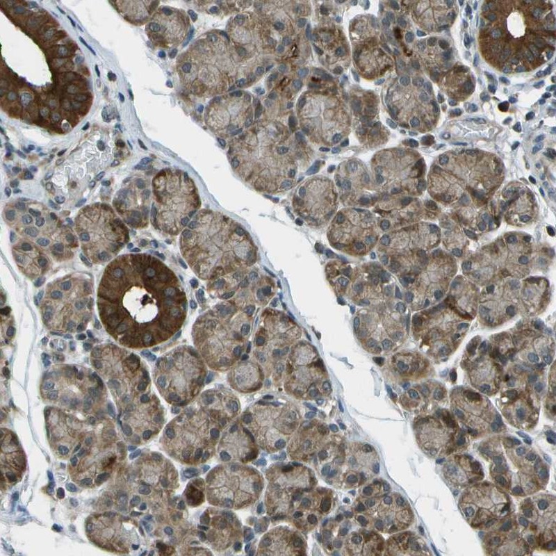 Anti-TMEM19 Antibody