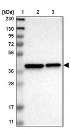 Lane 1: Marker [kDa] 230, 130, 95, 72, 56, 36, 28, 17, 11_br/_Lane 2: Human cell line RT-4_br/_Lane 3: Human cell line U-251MG sp
