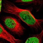 Immunofluorescent staining of human cell line U-2 OS shows localization to nucleoplasm.