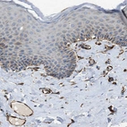 Anti-ZNF831 Antibody