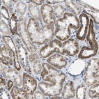 Anti-SLC25A31 Antibody