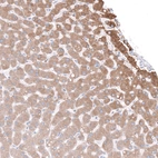 Immunohistochemical staining of human liver shows strong cytoplasmic positivity in hepatocytes.