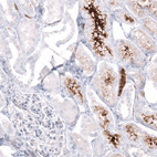 Immunohistochemical staining of human kidney shows strong cytoplasmic/ secreted positivity in cells in tubules.
