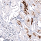 Immunohistochemical staining of human kidney shows strong cytoplasmic/ secreted positivity in cells in tubules.