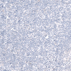 Anti-INHBE Antibody