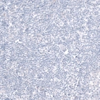 Immunohistochemical staining of human tonsil shows no positivity in non-germinal center cells as expected.