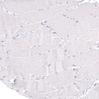 Immunohistochemical staining of human skeletal muscle shows no positivity in myocytes as expected.