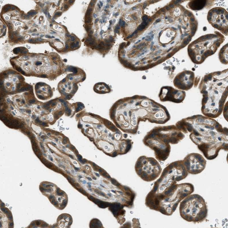 Anti-PTPN23 Antibody