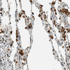 Immunohistochemical staining of human lung shows strong cytoplasmic positivity in macrophages.