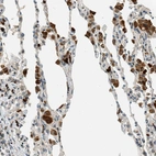 Immunohistochemical staining of human lung shows strong cytoplasmic positivity in macrophages.