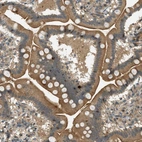 Immunohistochemical staining of human small intestine shows moderate cytoplasmic positivity in glandular cells.