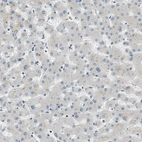Immunohistochemical staining of human liver shows very weak cytoplasmic positivity in hepatocytes.